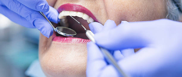 Best Chipped Tooth Repair Near Me  in Carrboro, NC